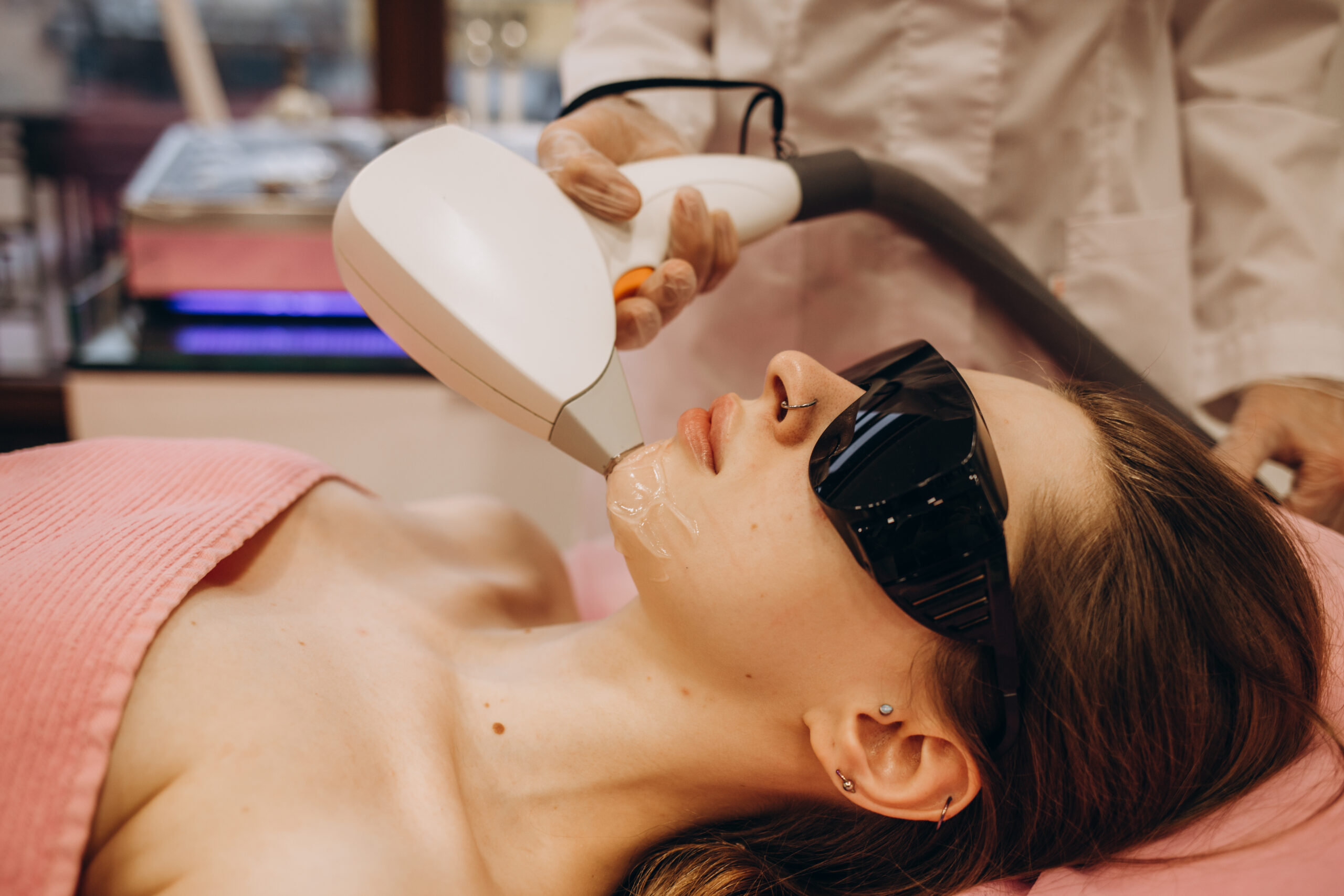 İstanbul epilasyon merkezi - lazer epilasyon uygulaması 5